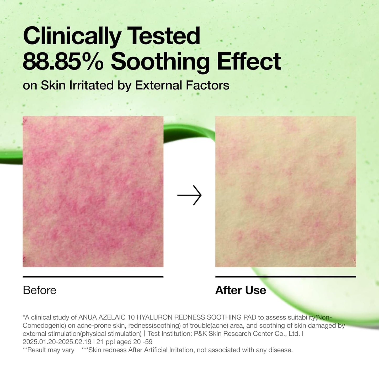 Anua Azelaic 10 + Hyaluron Redness Soothing Pad