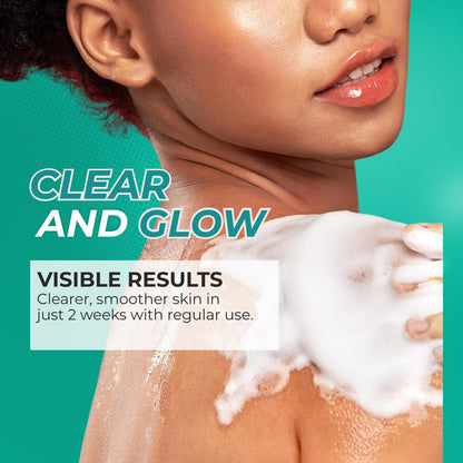 THE LOVE CO 1% Salicylic Acid Body Wash 236ml | Body & Back Acne | Paraben & SLS Free | Prevents Dry, Rough, Bumpy, and Strawberry Skin | Deep Cleanses Skin | For Men & Women | Body Shower Gel