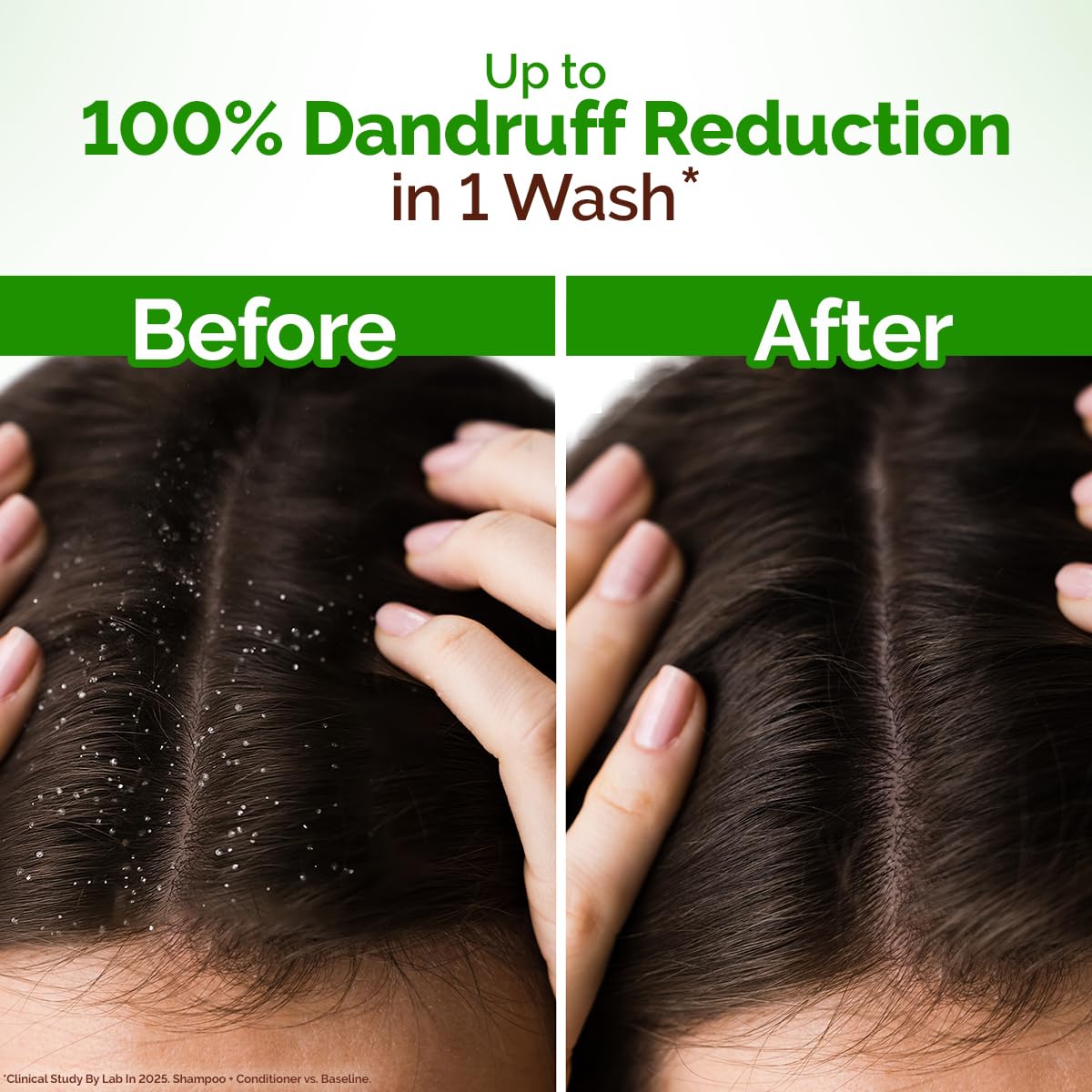 Mamaearth Lemon Anti-Dandruff Shampoo with Lemon, ZPTO, Climbazole, Aloe Vera for Itchy & Flaky Scalp | Upto 100% Dandruff Reduction & 3X Softer Hair in 1 Wash | Soothes Scalp | Reduces Frizz | 600 ml