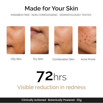 Personal Touch Zitsit Acne Spot Corrector Gel | 2% Salicylic Acid, Niacinamide & Zinc | Spot Corrector for Acne Marks, Dark Spots & Scars | Oil Control for Acne-Prone Skin | 20g
