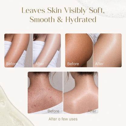 Seoulskin Exfoliating Shower Oil with 1% Salicylic Acid & 1% Lactic Acid | For Body Acne, Strawberry Skin, De-Tan | With Avocado & Rosehip Oil | Gentle Exfoliating Shower Gel | Oil-to-Foam Lather | Non-Drying | Korean Skincare | Shower Oil | 300 ml