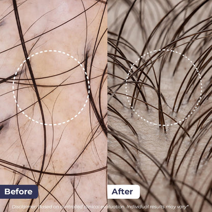 Before and after comparison of hair growth on skin