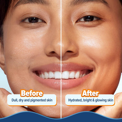 Aqualogica Glow+ Hydra Gel Moisturizer with Vitamin C & Papaya - 100 g|24-Hour Intense Hydration|Weightless Water-Like Gel Texture|Non Sticky & Quick Absorbing for Glowing Skin
