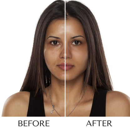 Before and after comparison of a woman's face with a white patch on her cheek.
