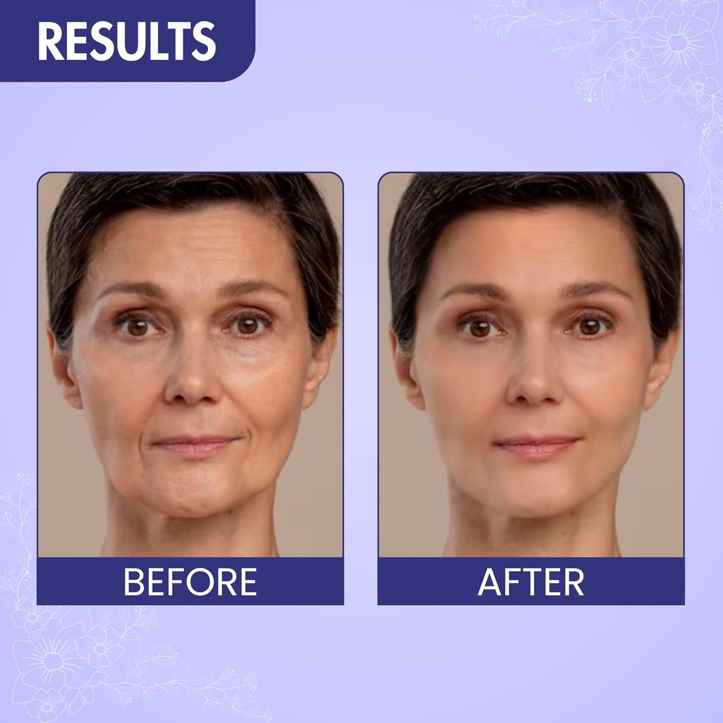 DERMOSYS Argireline Wrinkle Reducer Serum | With Collagen & Hydrolyzed Wheat Protein | Hydrating & Anti-Aging | Daily Use Serum | For All Skin Types - 30ml