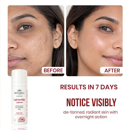 Mitchell USA LightenUp Express Overnight De-Tan Gel for Face | Tan Removal, Skin Brightening & Dark Spot Reduction | With Peony Flower Extract, Vitamin C & Alpha Arbutin | for Men & Women | 50g