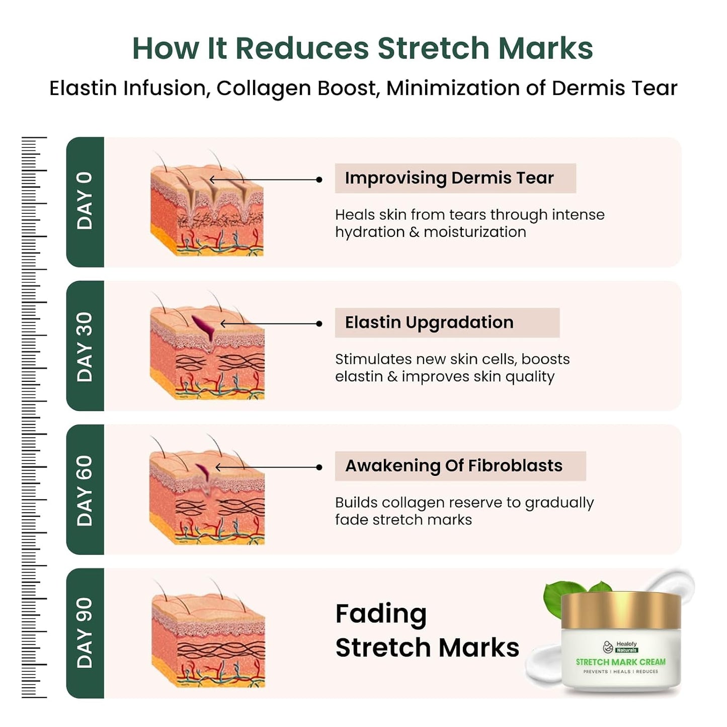Healofy Stretch Marks Cream for Pregnancy & Post-Delivery | Reduces Stretch Marks & Scars | Blend of Oil & Butters | With Aloe Vera, Shea. Cocoa, Coconut & More| Pack of 1-100 grams