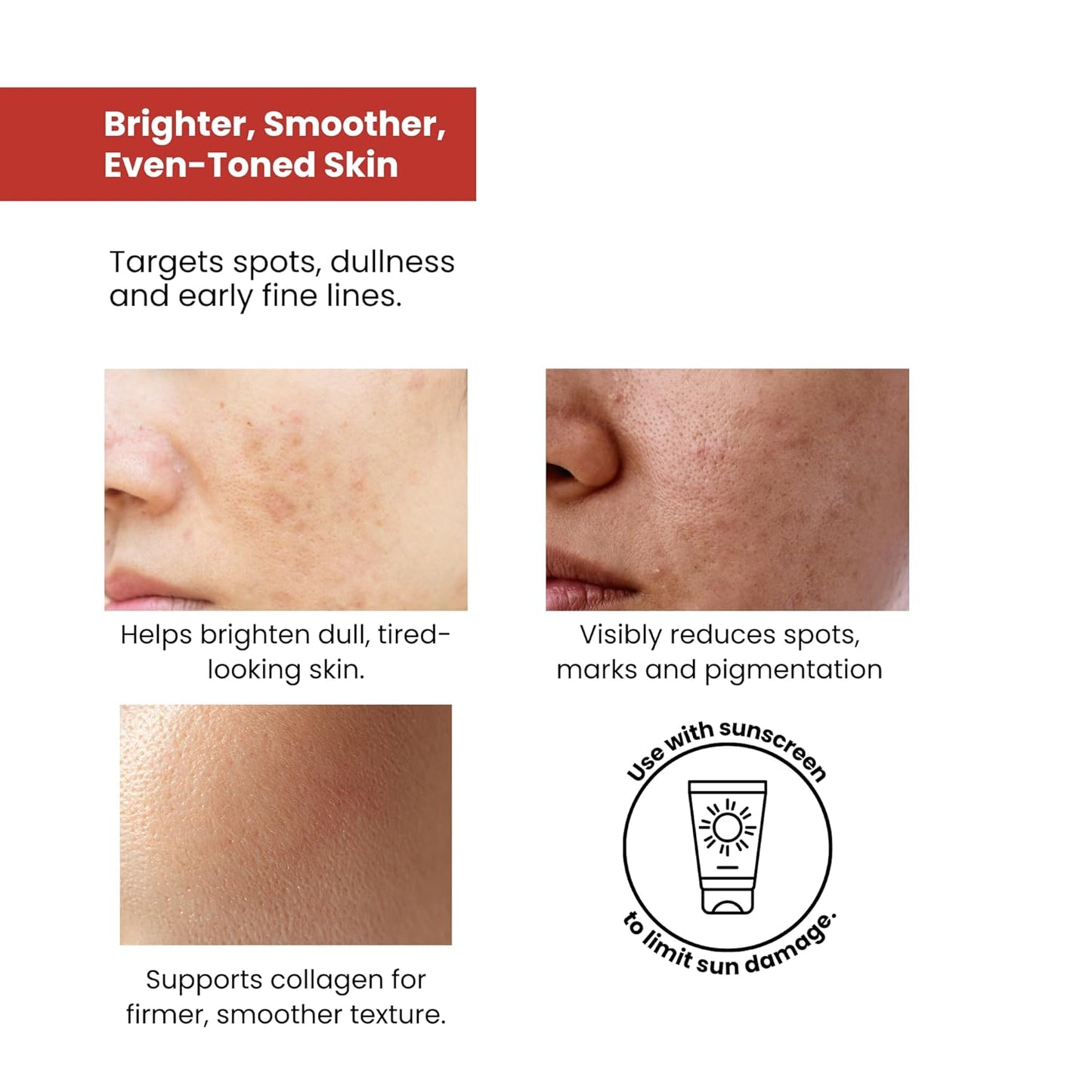 The True Therapy Vitamin C Serum for Glowing Skin, Skin Brightening Serum for Face with 10% L-Ascorbic Acid Face Serum, Fragrance Free – 30 ml