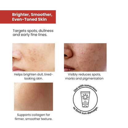 The True Therapy Vitamin C Serum for Glowing Skin, Skin Brightening Serum for Face with 10% L-Ascorbic Acid Face Serum, Fragrance Free – 30 ml