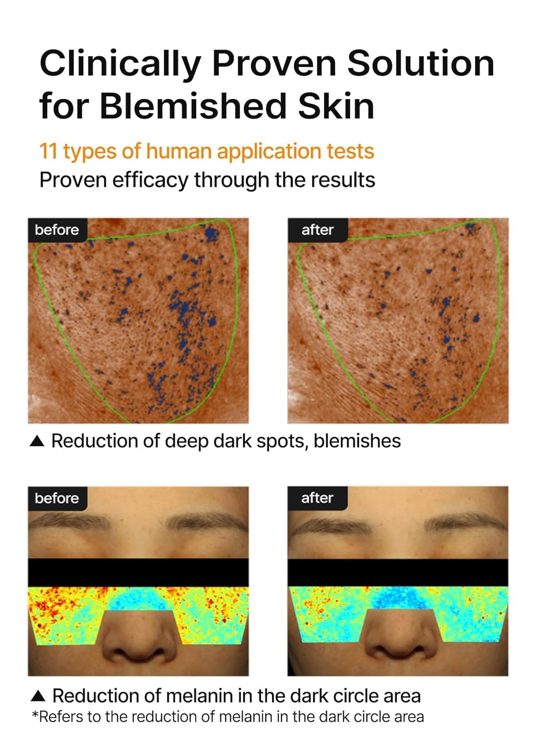 celimax Pore+Dark Spot Brightening Cream 35ml | Korean Brightening Moisturiser for Hyperpigmentation & Uneven Skin Tone | Niacinamide, Hyaluronic Acid, Ceramides & Centella | Minimises Pores, Reduces Dark Spots, Barrier Repair & Deep Hydration