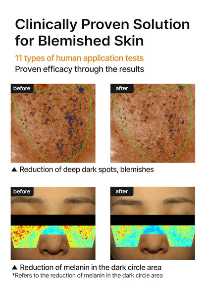 celimax Pore+Dark Spot Brightening Cream 35ml | Korean Brightening Moisturiser for Hyperpigmentation & Uneven Skin Tone | Niacinamide, Hyaluronic Acid, Ceramides & Centella | Minimises Pores, Reduces Dark Spots, Barrier Repair & Deep Hydration