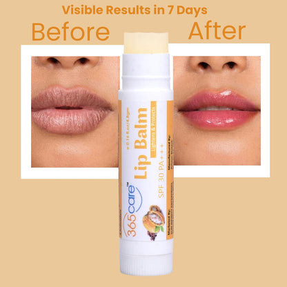 365CARE SPF 30 Lip Balm for Dark Lips Lightening & Pigmentation | Cocoa Butter Lip Balm for Smokers, Dry & Chapped Lips | 24hr Deep Moisturizing & Sun Protection PA+++ for Men & Women - 4.8g