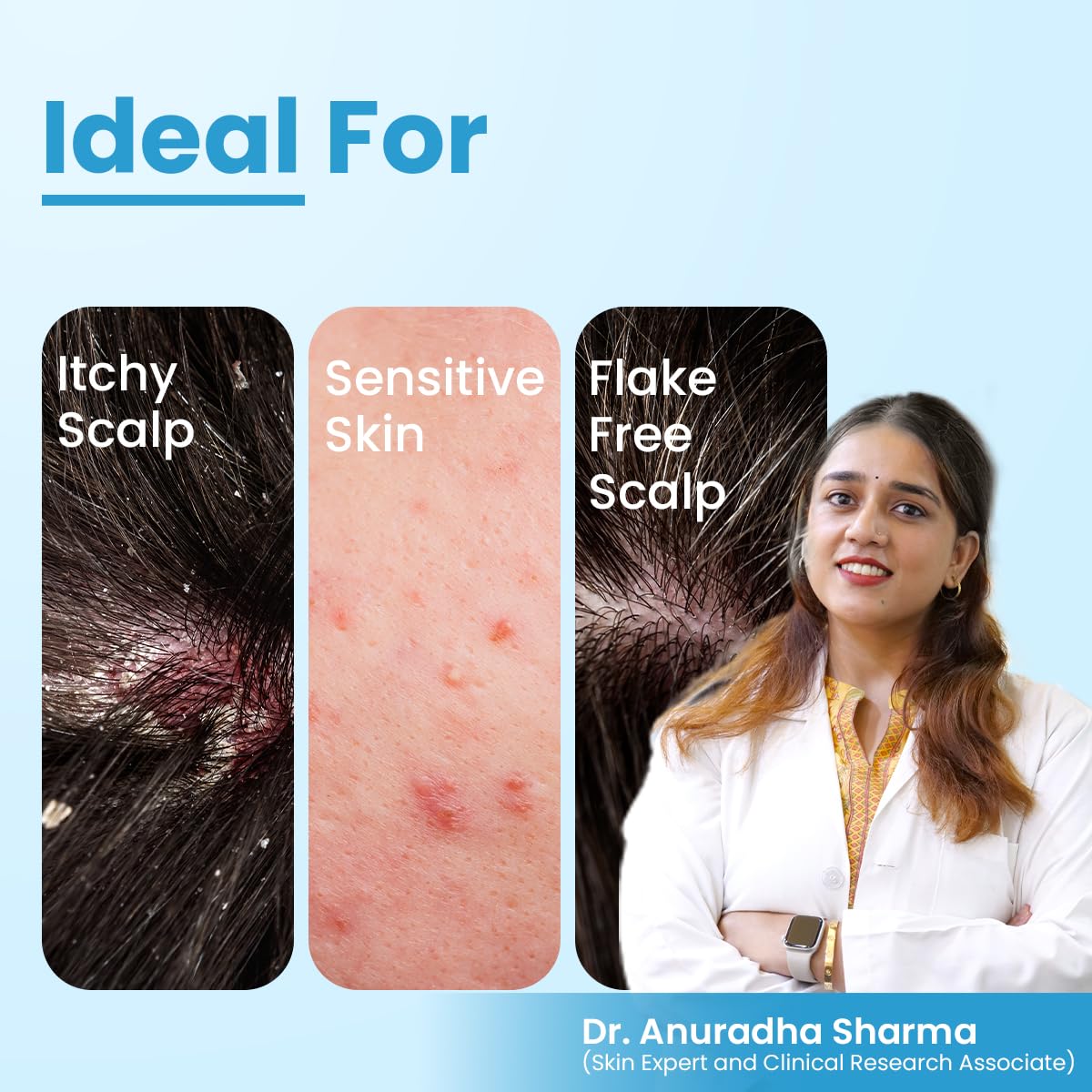 FCL T-Shampoo For Dandruff, Itchy Scalp, Scalp Psoriasis & Seborrheic Dermatitis | Removes Excess Oil & Flake Free Scalp | Anti Dandruff Shampoo | Sulphate & Paraben Free | For Sensitive Skin - 200 ml