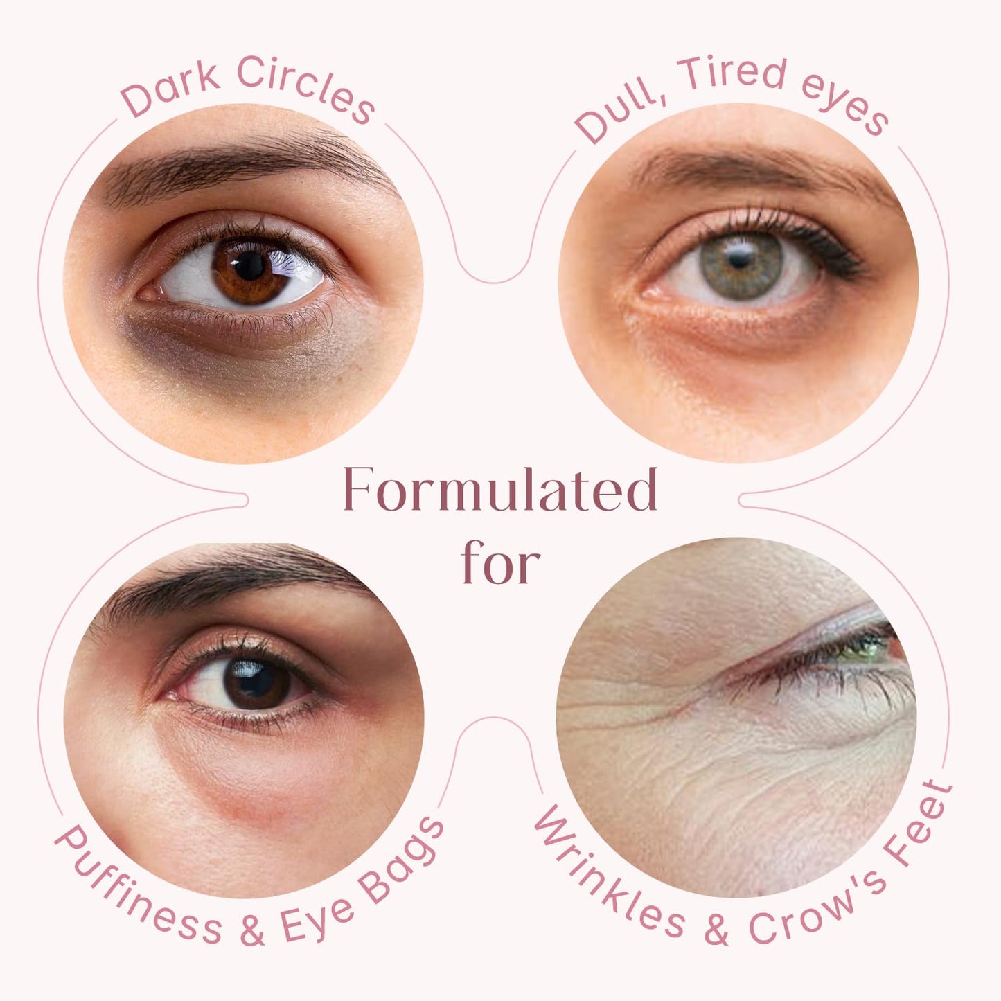 Seoulskin under eye cream | dark circles removal for women and men | Under Eye Gel to Reduce Dark Circles, Puffiness & Wrinkles With Built-in Cooling Massage Roll-On Applicator | 5% Niacinamide, 2% Alpha Arbutin | 15 ml