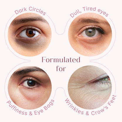 Seoulskin under eye cream | dark circles removal for women and men | Under Eye Gel to Reduce Dark Circles, Puffiness & Wrinkles With Built-in Cooling Massage Roll-On Applicator | 5% Niacinamide, 2% Alpha Arbutin | 15 ml