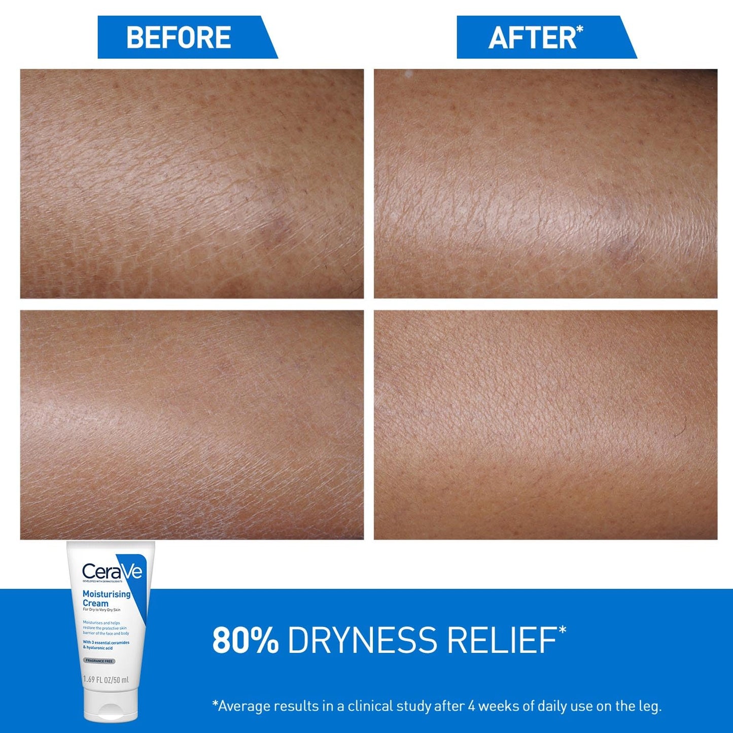 Before and after comparison of skin with CeraVe moisturizing cream shown.