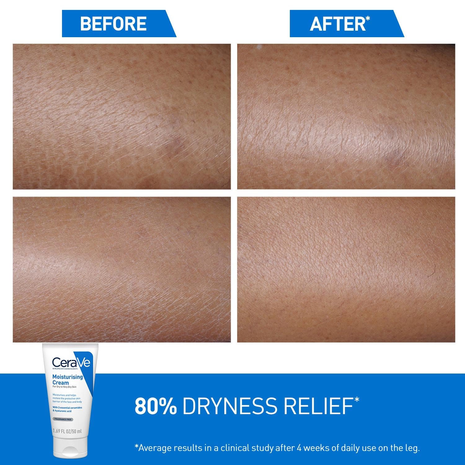 Before and after comparison of skin with CeraVe moisturizing cream shown.