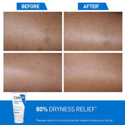 Before and after comparison of skin with CeraVe moisturizing cream shown.
