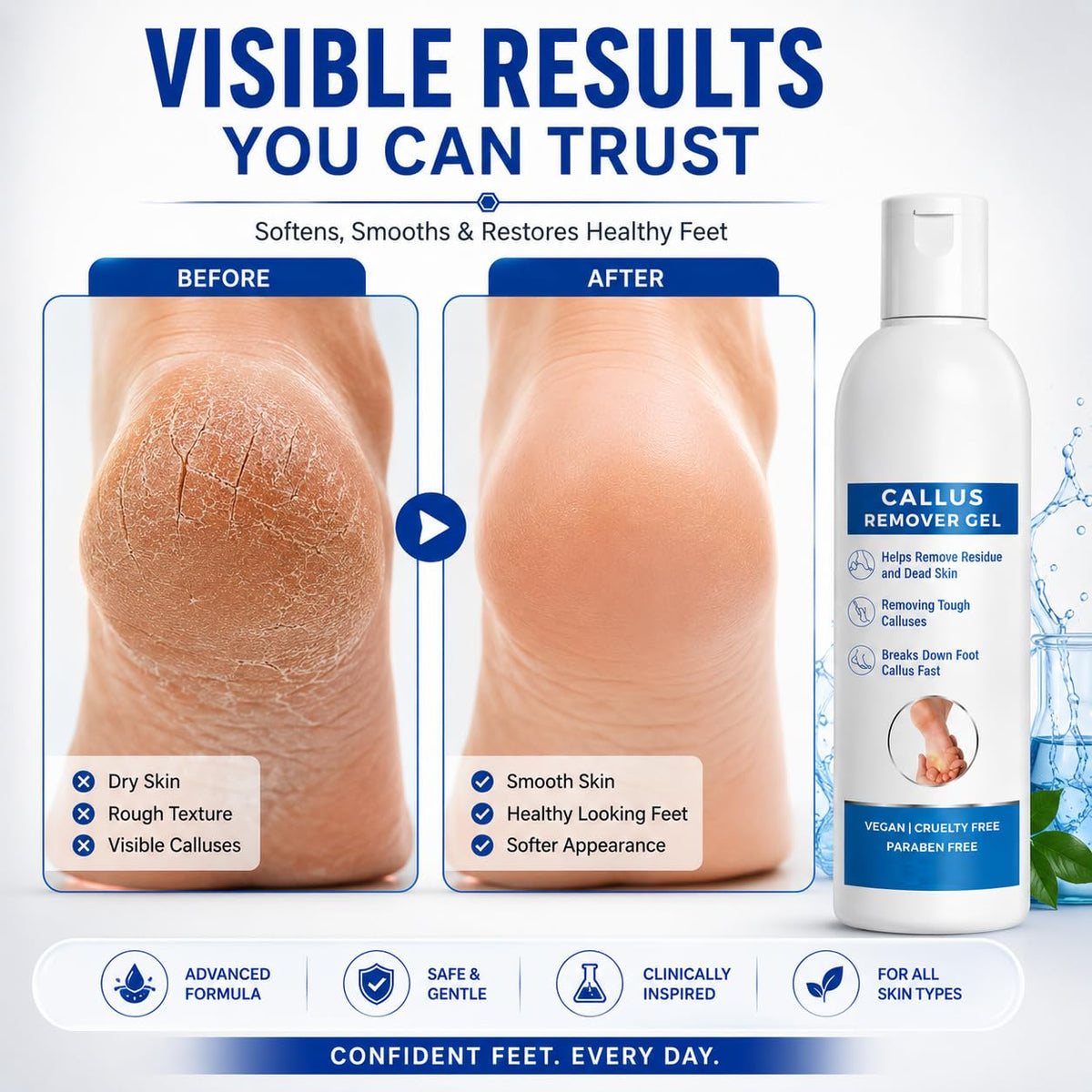 Callus Remover Gel for Feet, Softening and Exfoliating Formula, Dry Rough Skin Care, 200ml, for Men and Women
