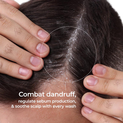 Close-up of scalp with dandruff, showing hands holding hair, with text about combating dandruff.