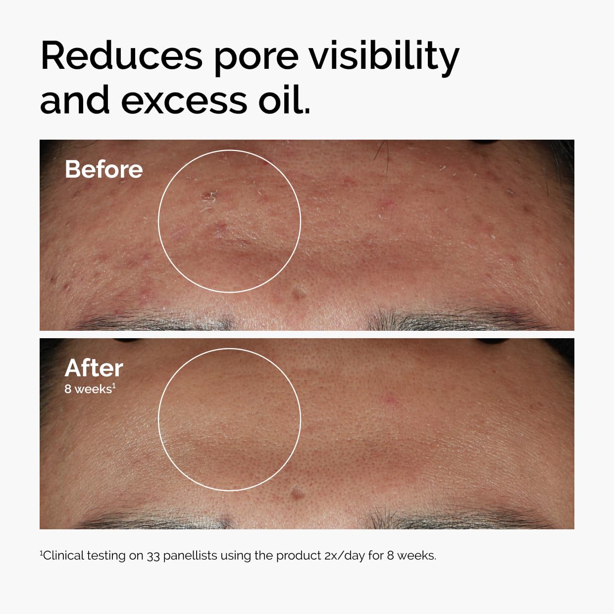 Before and after comparison of skin with pore visibility and excess oil reduction, showing clinical testing results.