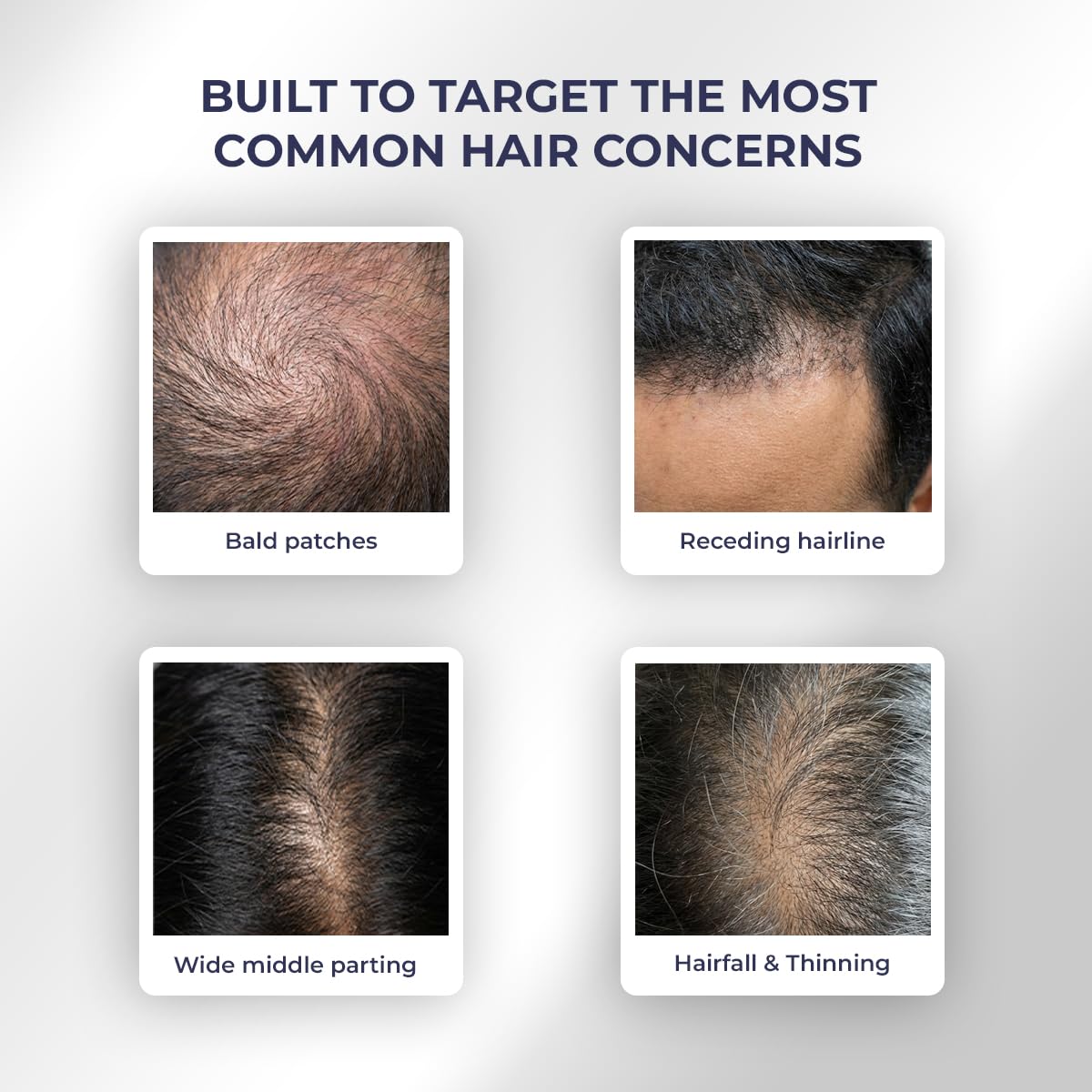 Images of bald patches, receding hairline, wide middle parting, and hairfall & thinning with text 'Built to target the most common hair concerns'.