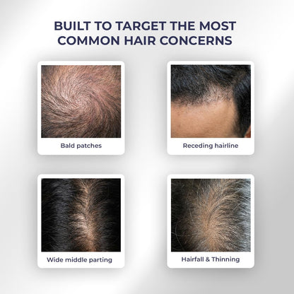 Images of bald patches, receding hairline, wide middle parting, and hairfall & thinning with text 'Built to target the most common hair concerns'.