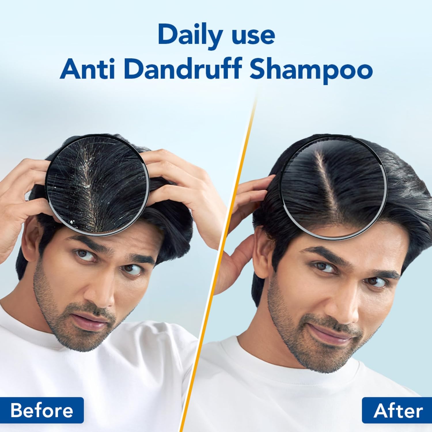 Before and after comparison of a man using anti dandruff shampoo with text 'Daily use Anti Dandruff Shampoo'.