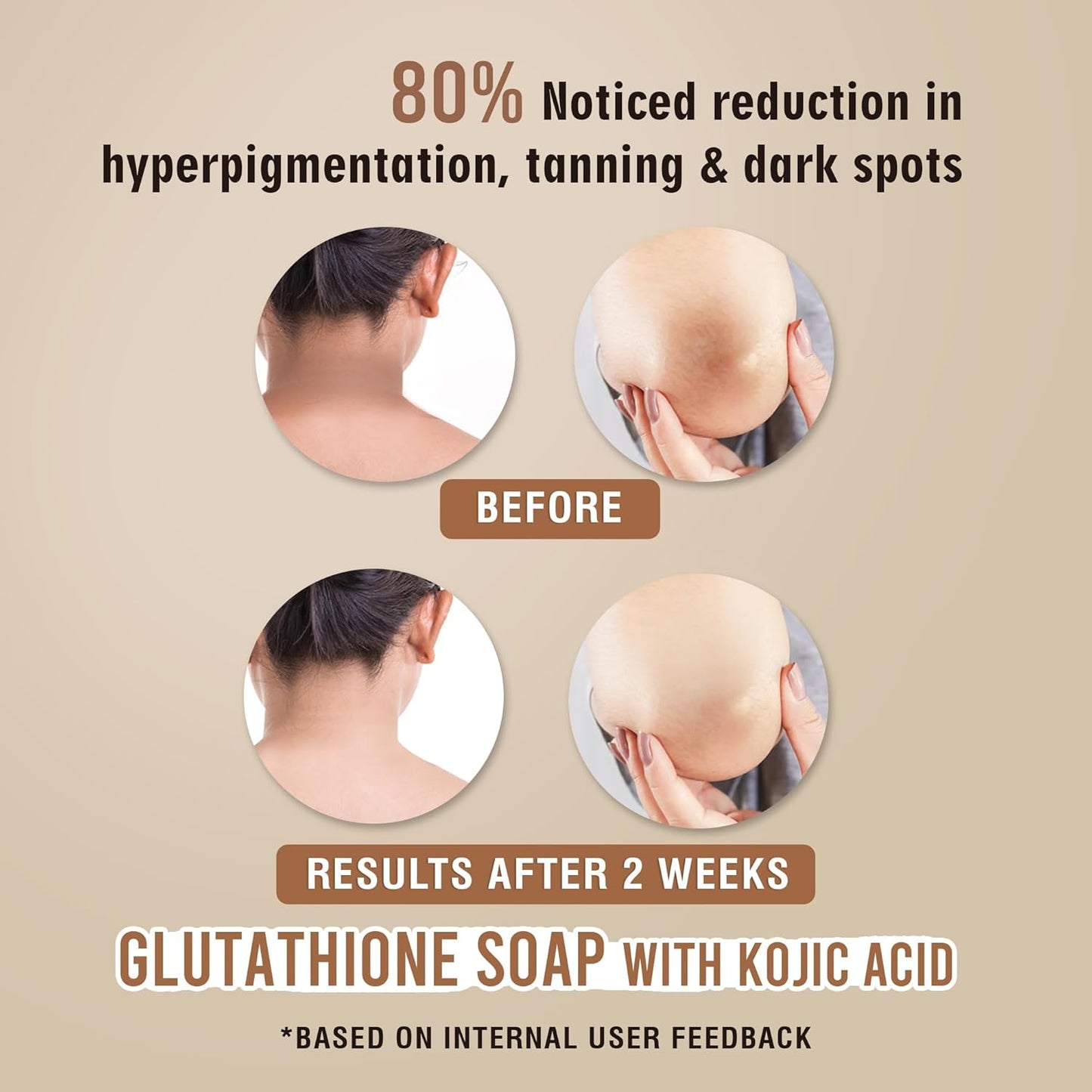 Glamveda Glutathione Skin Whitening Soap with Kojic Acid | Body Tan Removal | Bath for Men & Women | Remove Dark Spots & Hyperpigmentation | For Nourishing & Glowing Skin (Pack of 2)