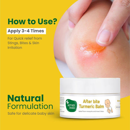 Mother Sparsh After Bite Turmeric Balm for Rashes And Mosquito Bites, 100% Ayurvedic, Gentle Skin Roll-On Formula, 25gm