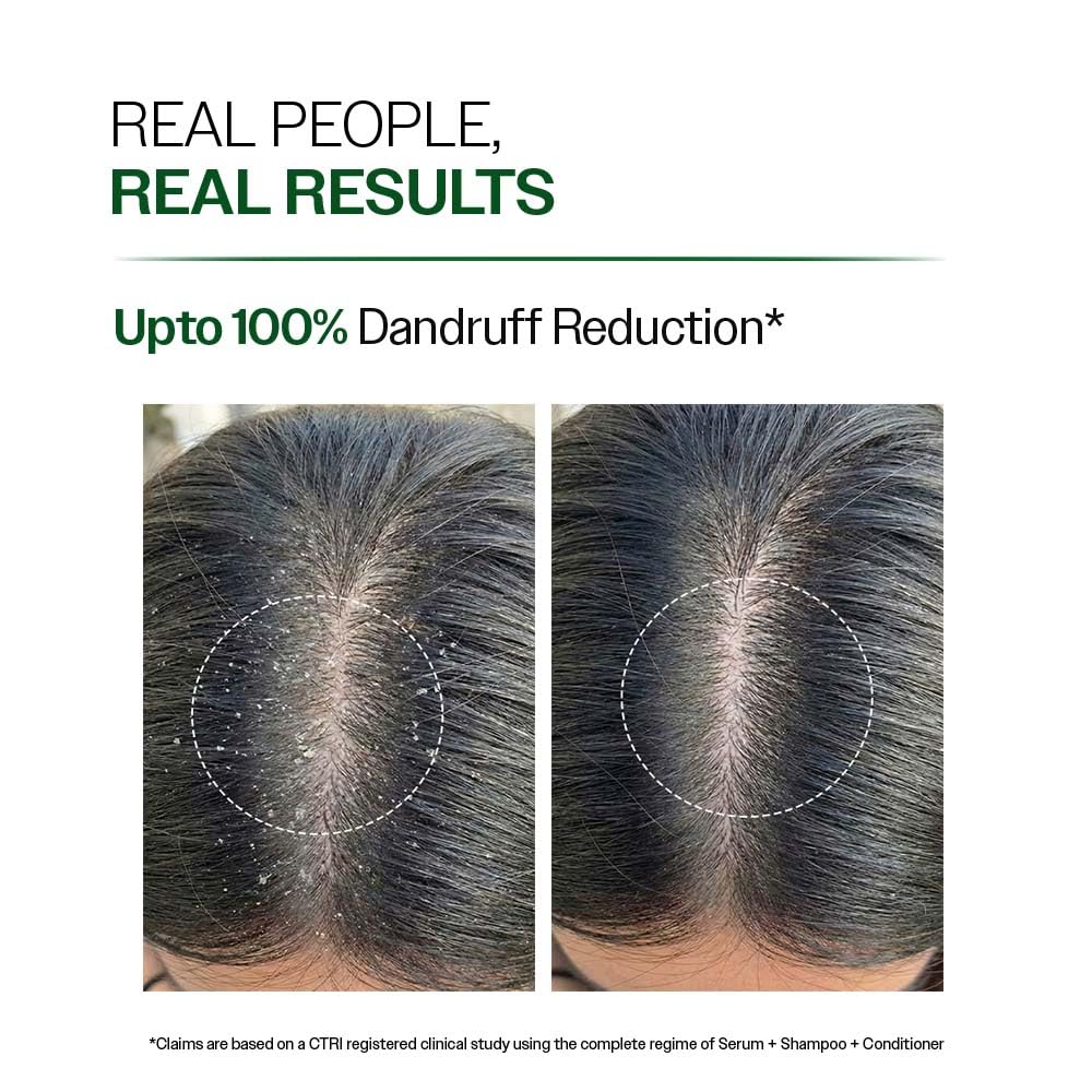 Bare Anatomy Anti-Dandruff Shampoo | Up To 100% Dandruff Reduction | ZPTO-Free | pH 5.3 | Salicylic Acid, Piroctone Olamine, Biotin & Menthol | Non-Drying Formula | Suitable for Men & Women | 250 ml