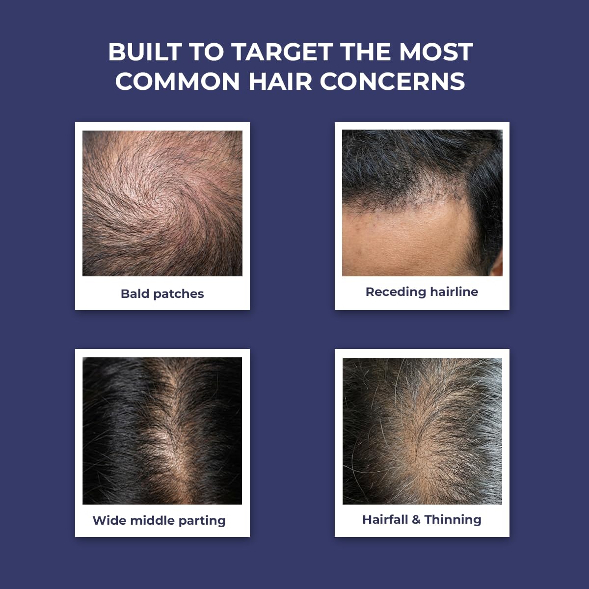 Advertisement for hair care product targeting common hair concerns with images of bald patches, receding hairline, wide middle parting, and hairfall & thinning.