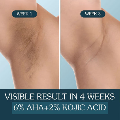 BAKE BrightErase™ Underarm Brightening Roll On Serum with 6% AHA Complex, 2% Kojic Acid, 3% Niacinamide | Reduces Pigmentation, Dark Spots, Odour & Sweat | Brightening & Exfoliating Serum for Dark Underarms - 50ml