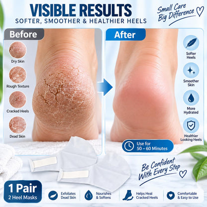 KYTRONIC Exfoliating Heel Mask for Dry, Rough & Cracked Heels, 1 Pair Heel care mask with moisturizing essence for dry, rough skin, dead skin and callus care; easy adhesive fit, 1 pair