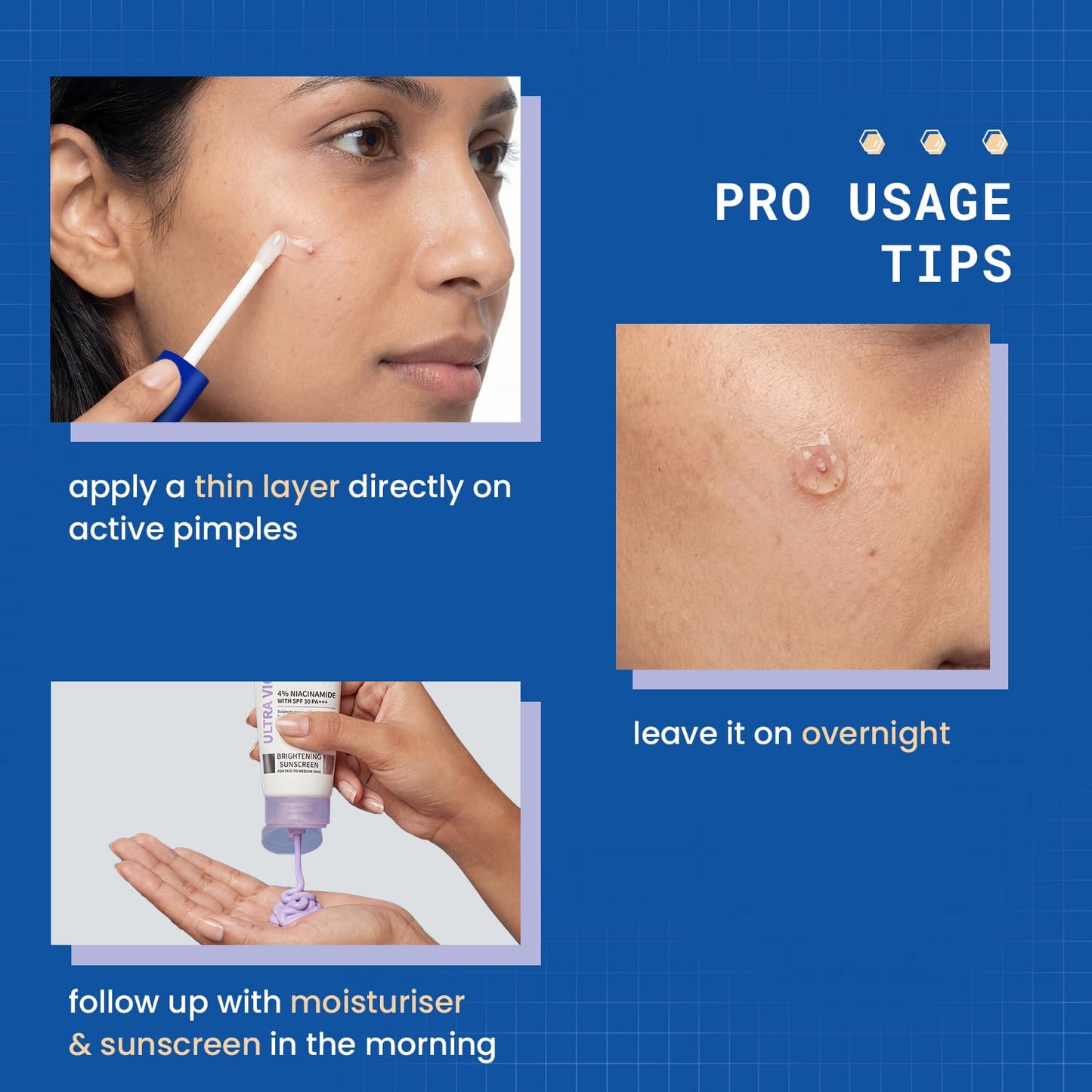DERMDOC 2% Salicylic Acid w/w Pimple Gel, 5ml | Acne Spot Treatment for Oily & Acne-Prone Skin | Reduces Pimples, Redness & Inflammation | Clears Clogged Pores | Lightweight & Fast Absorbing | Anti-Acne Gel for Breakouts & Active Pimples