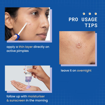 DERMDOC 2% Salicylic Acid w/w Pimple Gel, 5ml | Acne Spot Treatment for Oily & Acne-Prone Skin | Reduces Pimples, Redness & Inflammation | Clears Clogged Pores | Lightweight & Fast Absorbing | Anti-Acne Gel for Breakouts & Active Pimples