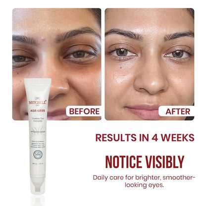 Mitchell USA Lineless Eye Serum – Peptide & Lotus Bio-Repair – Reduces Dark Circles, Wrinkles & Puffiness Lightweight Anti-Aging Formula 15ml
