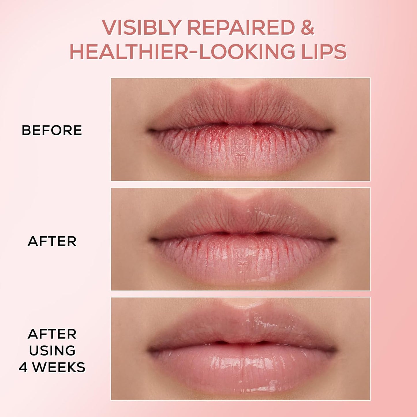 RENEE Pink Therapy PDRN Overnight Lip Repairing & Moisturising Lip Balm For Dry, Chapped Lips | Glossy Finish, Revives Lip Barrier & Improves Elasticity | With Vegan PDRN, Peptides & Ceramides | 10g