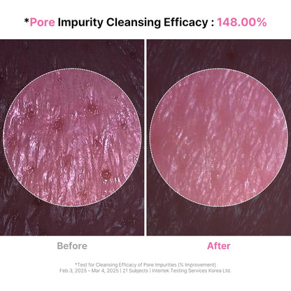 4-in-1 Konjac Jelly Face Cleanser – Gentle Daily Exfoliating, Deep Cleansing, Pore Care & Makeup Removal | Berry Smoothie Texture with Raspberry & Vitamin B+C+E Complex | Dermatologist-Tested - 130 ML