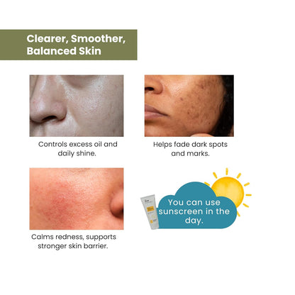 The True Therapy Niacinamide Face Serum 10% + Zinc PCA 1% - Pore Reducer, Uneven Skin Tone & Dark Spot Reducer, Treat Acne, Skin Balancing, Reduce Excess Oil & Skin Redness – 30 ml