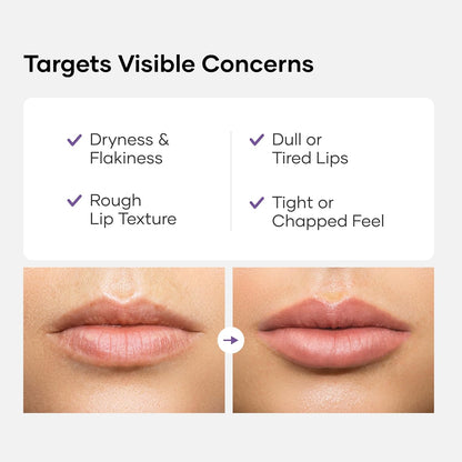 Cureskin Lip Deep Therapy Lip Mask | Moisturizing Lip Treatment with Vitamin C + Shea Butter for Soft Hydrated Lips | Overnight Repair | Lip Balm For Dry Chapped Lips | Lasting Hydration, 10 g (Pack of 1)