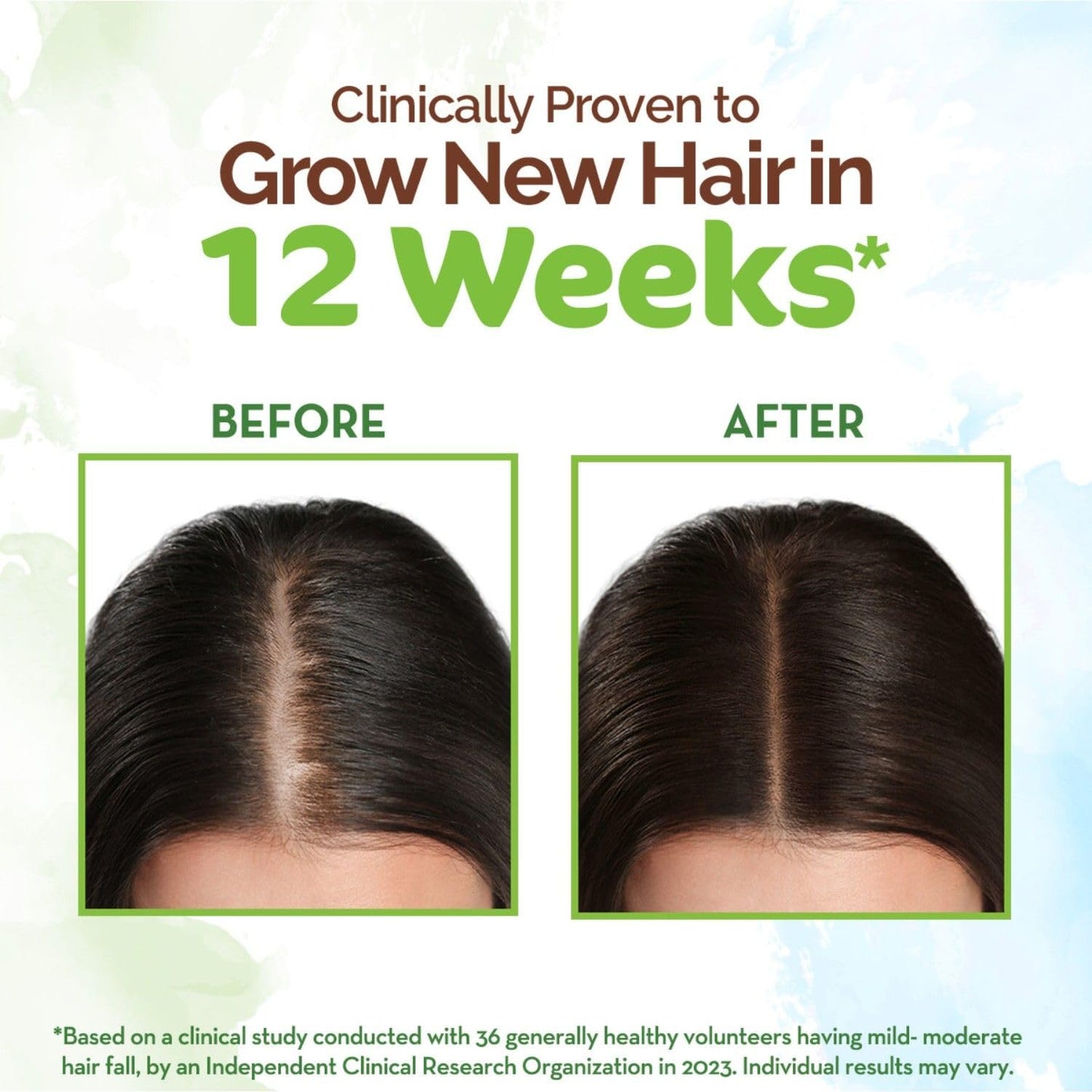 Mamaearth Rosemary & Methi Dana Hair Oil - Promotes Growth, Controls Fall, Strengthens & Stimulates New Growth | 200 ml