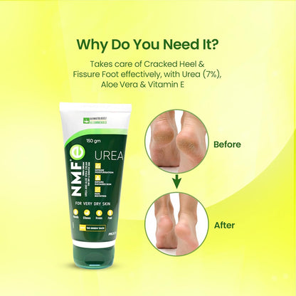 NMFe  150 gm For Intense Moisturisation with Urea 7% & Aloe vera for thick and dry skin | Truly the Healing Moisturiser | For very dry skin | Takes care of cracked heels & Fissure feet effectively