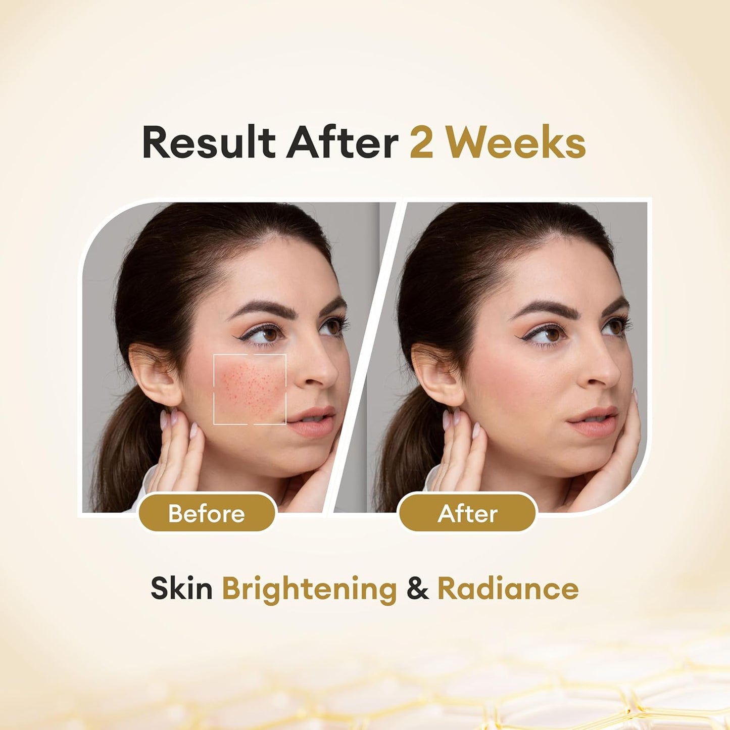 CO LUXURY Glutathione Skin Cream with Kojic Acid & Vitamin C | Reduce Dark spots & Hyperpigmentation | Glutathione Cream for Men & Women, 30gm