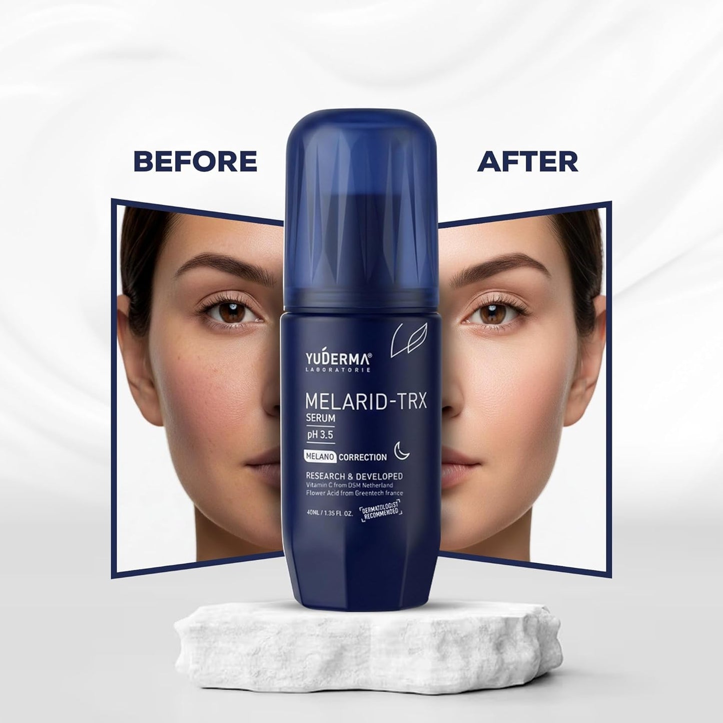 Yuderma Melarid Dark Spot Correcting Serum – TRX Serum pH 3.5 – For Melano Correction & Pigmentation – For Uneven Skin Tone, 40ml
