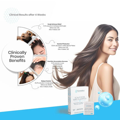 Yumedics Scalp Dose Sebo Anti Dandruff Shampoo | 150ml Liquid Anti Dandruff Shampoo for Women & Men | For Scalp Care, Sebum Control and Scalp Soothing