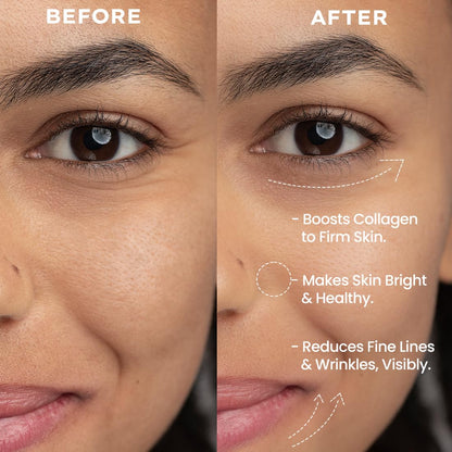 Before and after comparison of a woman's eye area with text highlighting skin benefits.