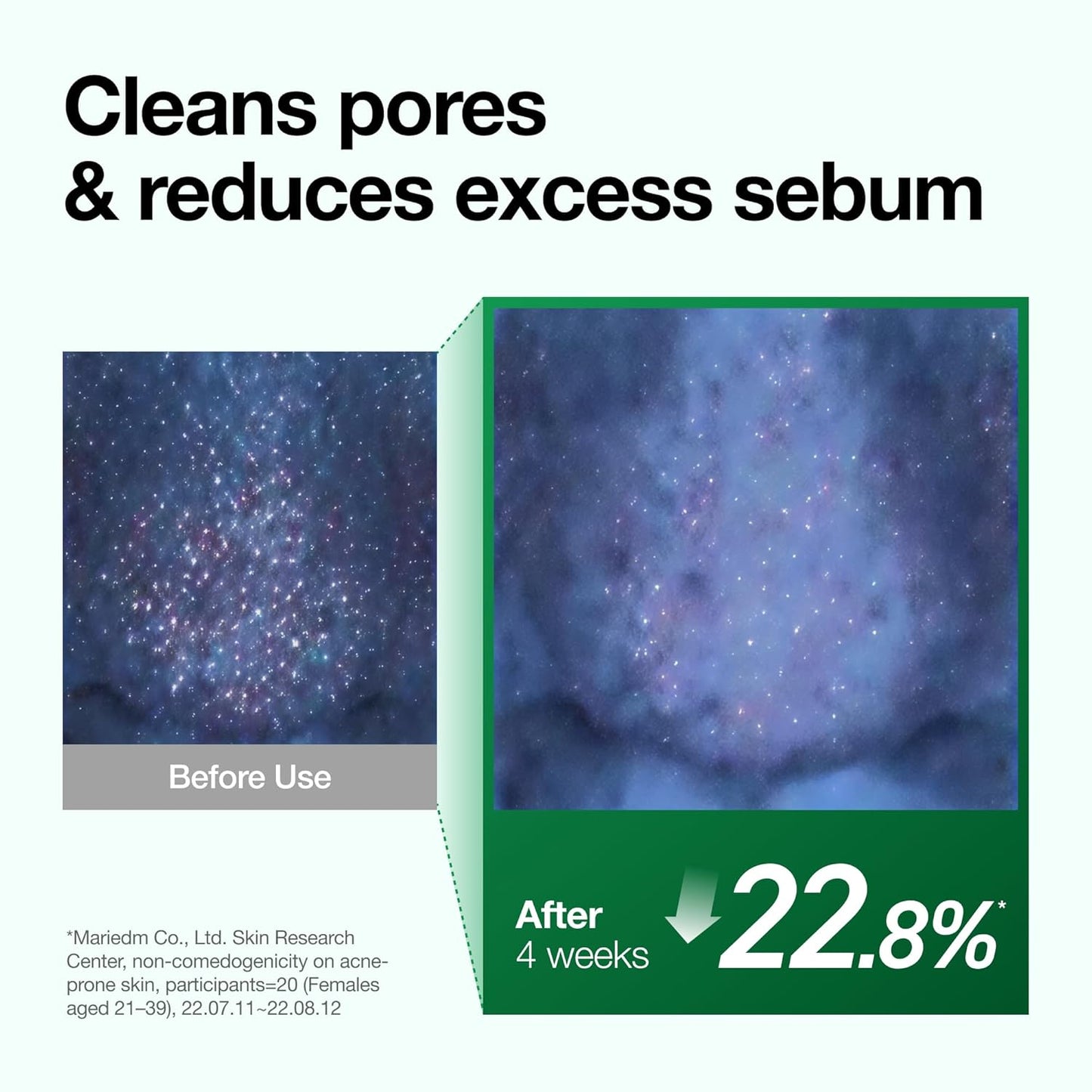 Anua Heartleaf Pore Control Cleansing Oil Removes Makeup, Excess Sebum, Blackheads & Clogged Pores