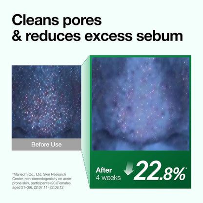 Anua Heartleaf Pore Control Cleansing Oil Removes Makeup, Excess Sebum, Blackheads & Clogged Pores