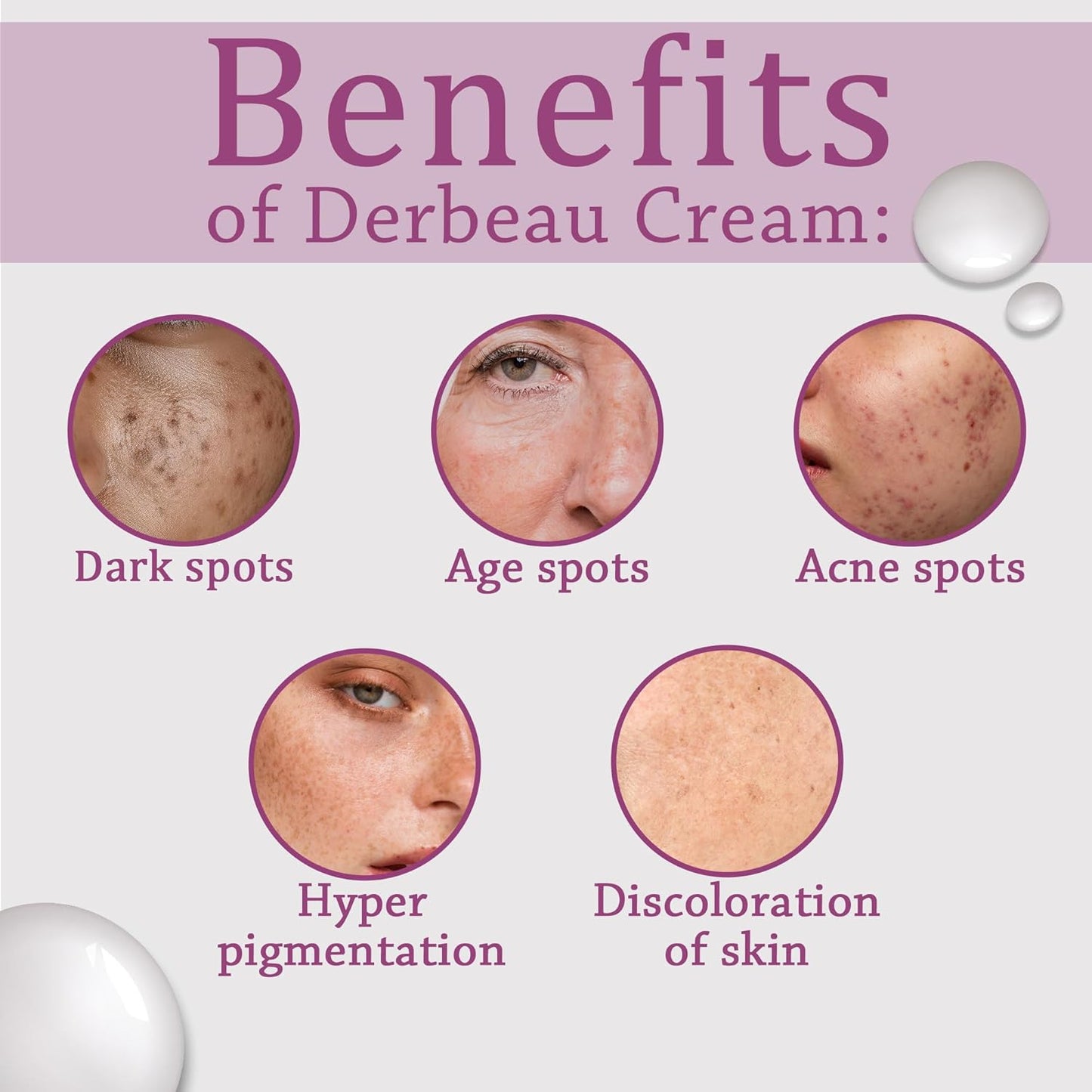 Healing Pharma - Derbeau® Glycolic Acid Cream 12% W/W, 30g